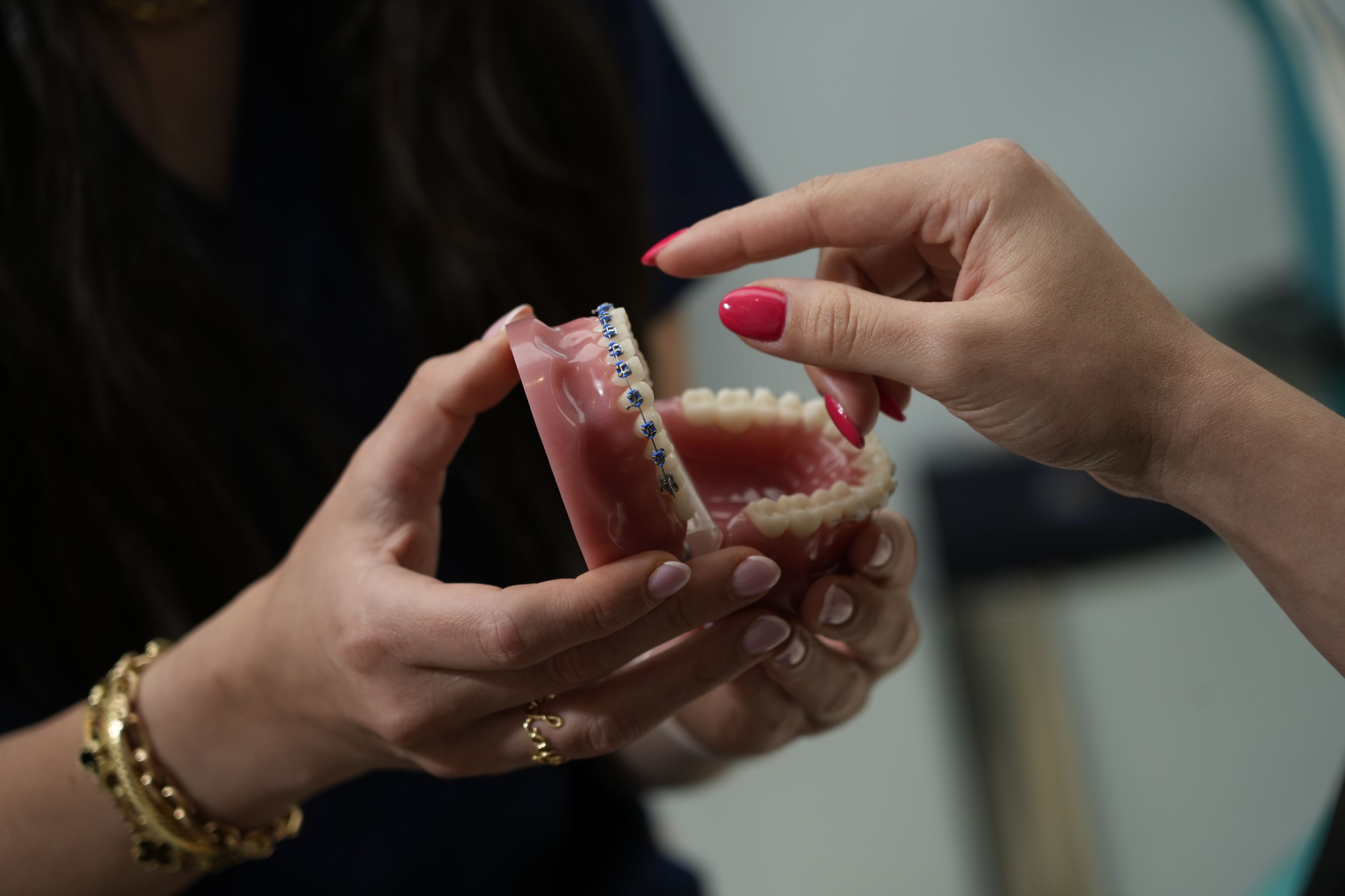 Metal & Ceramic Braces